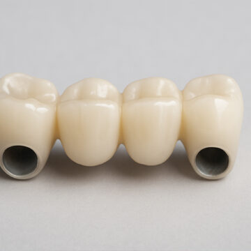 Did You Know That a Dental Crown Can Also Be Utilized to Support a Dental Bridge?