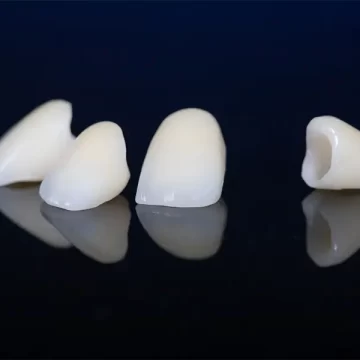 Why Dentists Recommend Crowns for Cracked or Weak Teeth